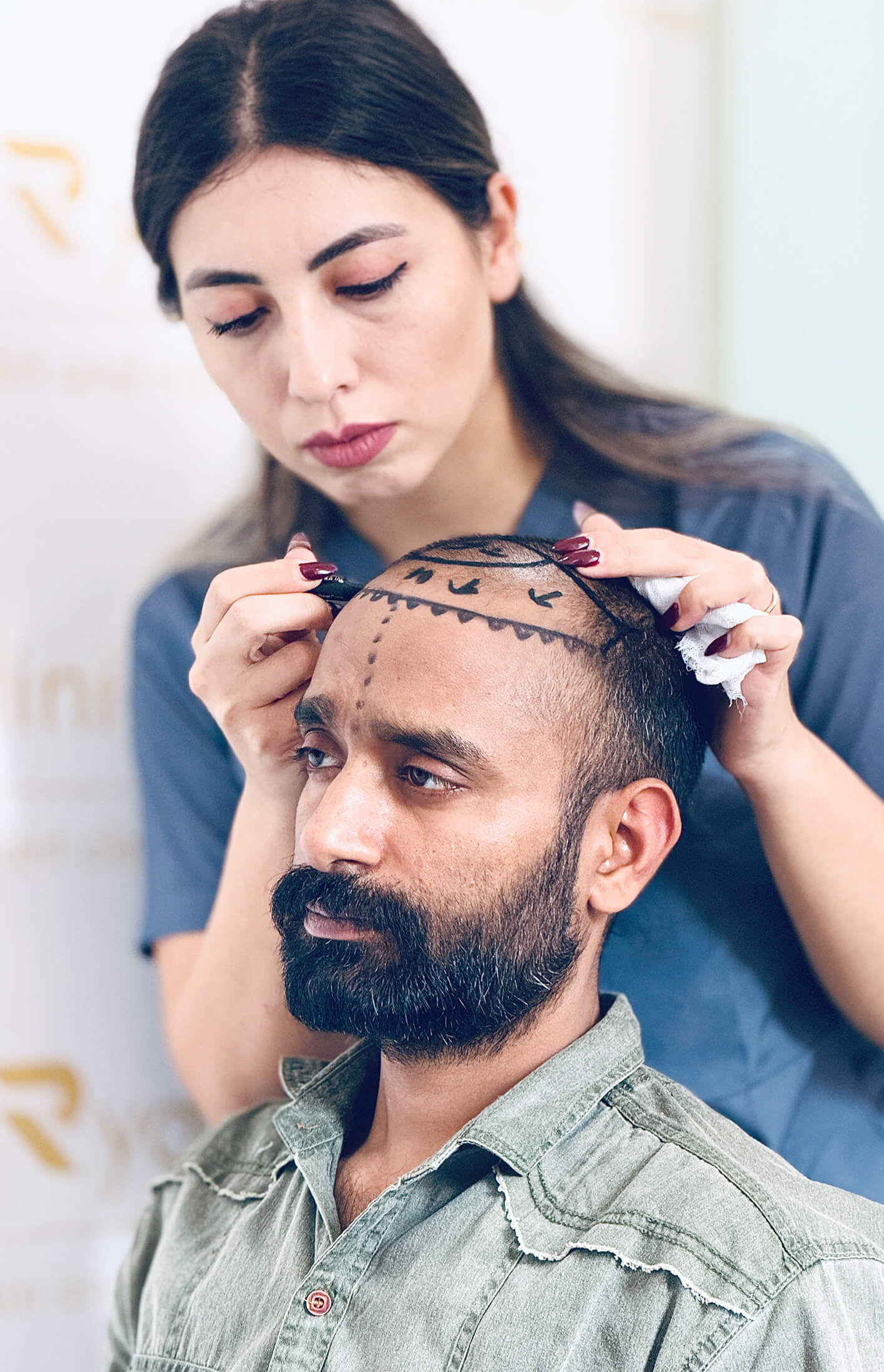 Hair transplant results Mumbai